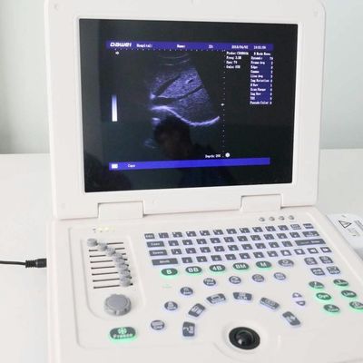 качество GYN Factory Supply Dw580 Portable Ultrasound Machine For Sale завод